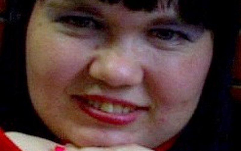 Синдром Робинова вызывает карликовость с необычным строением скелета, именуемой «фигурой мускулиста»