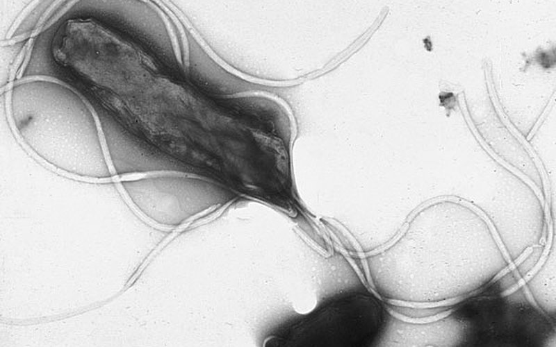 Бактерия Helicobacter pylori выживает в желудочной кислоте, образуя спираль и буря аммиака вокруг се