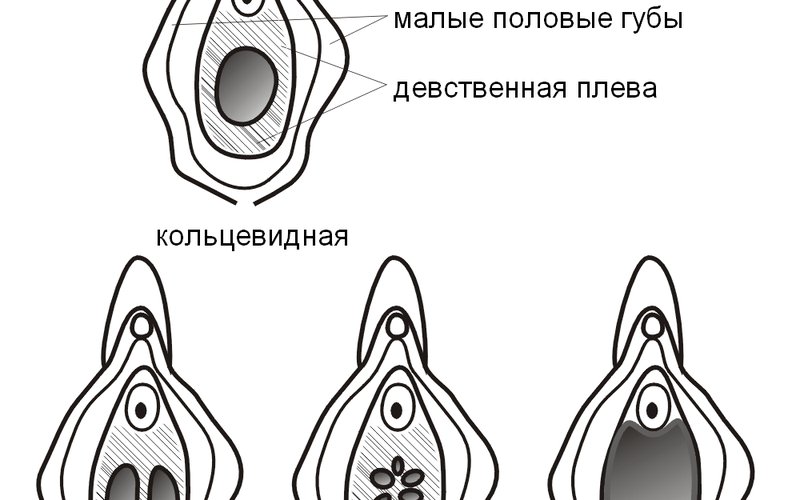 Люди с редким синдромом не ощущают боль и могут прожить до 40 лет без диагноза.